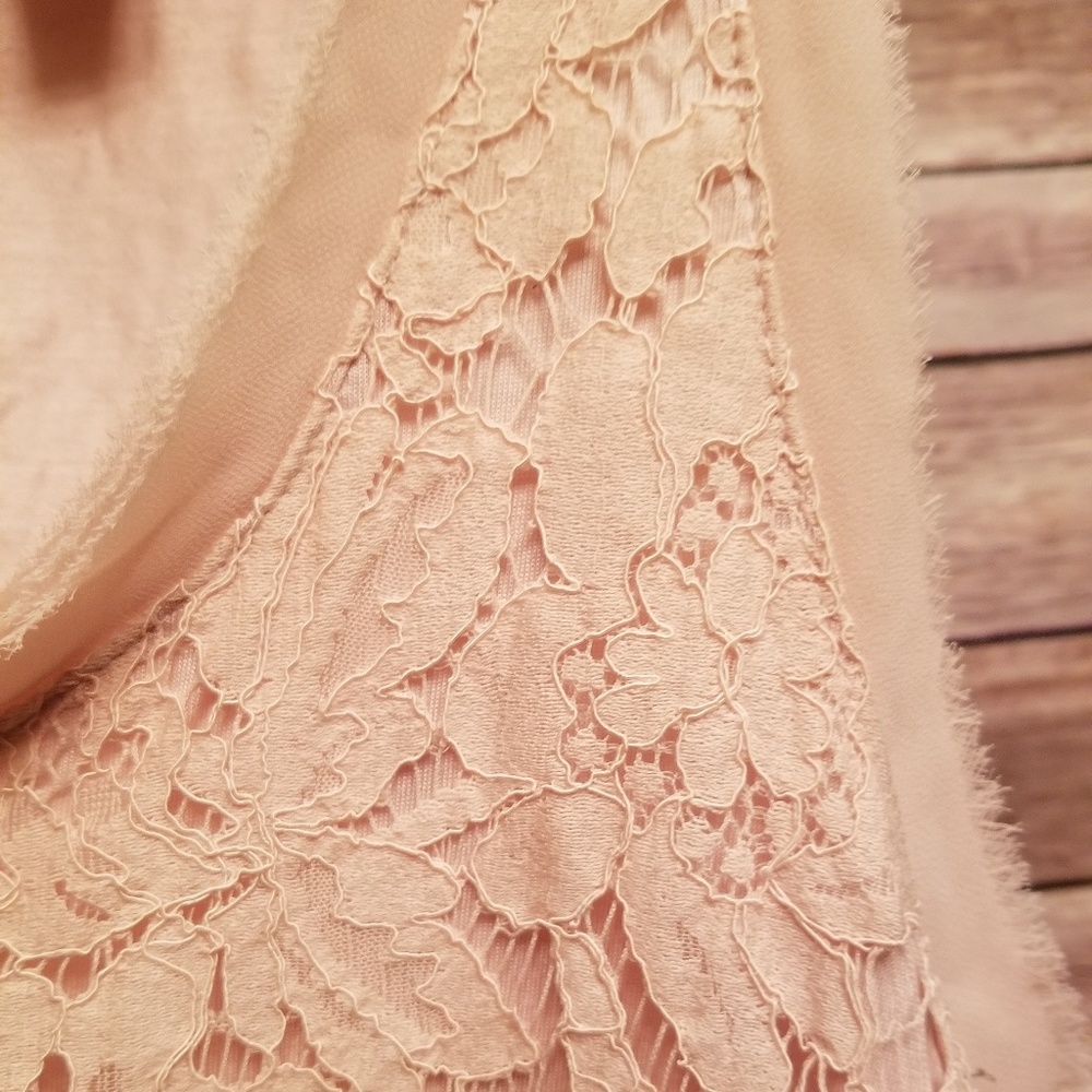 Scalloped lace top